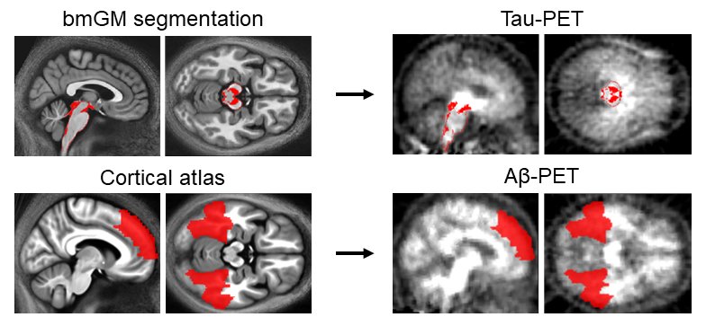 State-of-the-art automatic brainstem segmentation methods were used to extract...