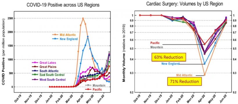 Regional Covid & cardiac surgery volume trends