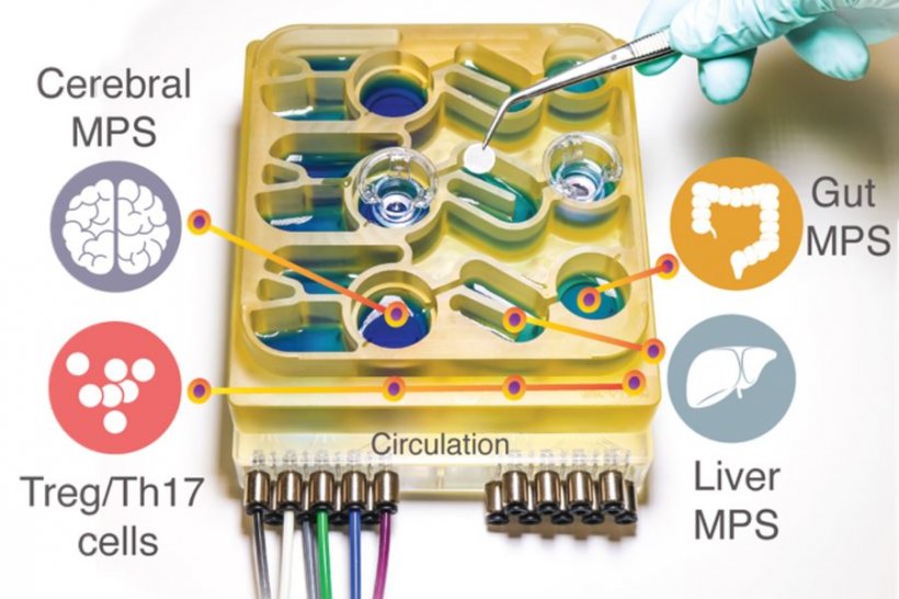 MIT researchers have developed an “organs-on-a-chip” system that replicates...