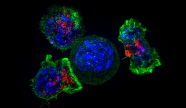 Targeted cancer therapy: Superresolution image of a group of killer T cells...