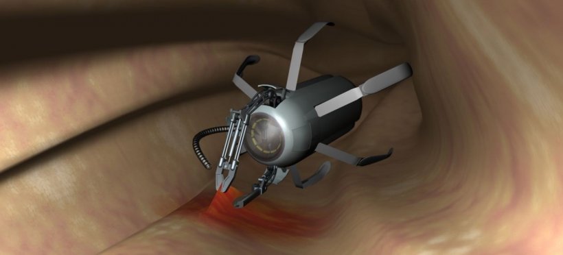Das winziges Implantat aus dem Projekt Versatile Endoscopic Capsule for...