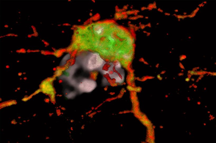 Neu entdeckter Zelltyp TAMEP (in rot) direkt neben einem Tumorzellkern (grau)