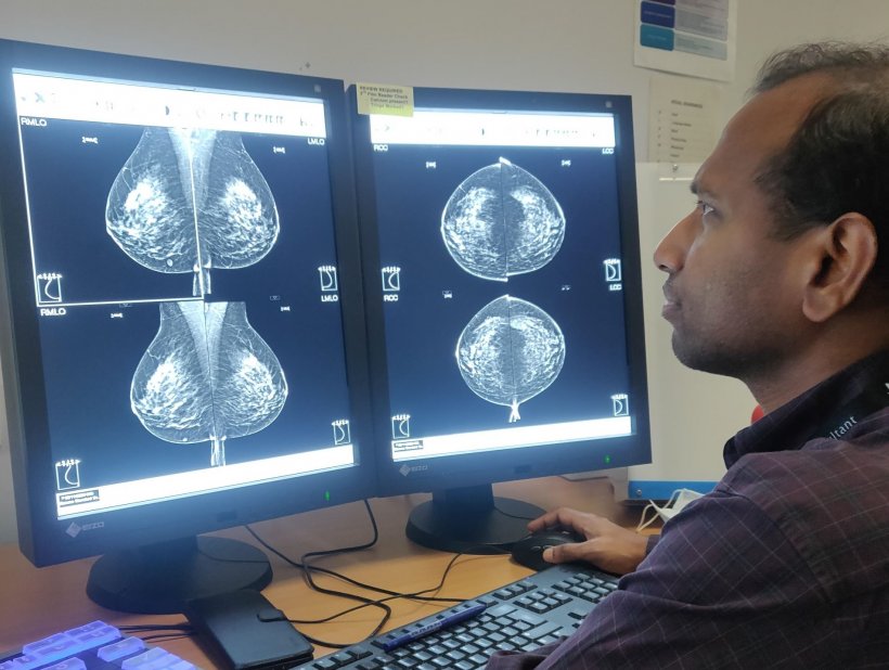 man looking at two computer screens displaying breast screening mammography...