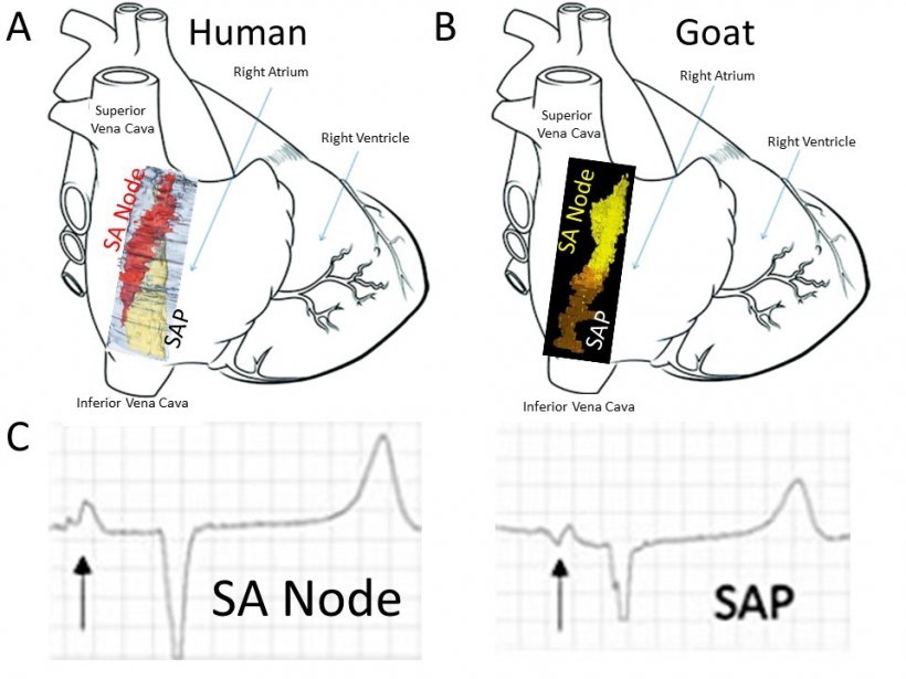 The SA node in a human (Figure A, red) and a goat (Figure B, yellow) before and...