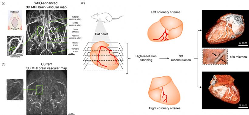 High-resolution 3D MRI brain vascular map: (a) High-resolution 3D MRI brain...