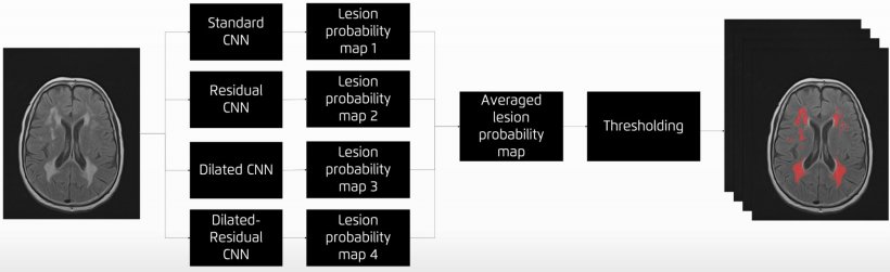 Example of using a combination of different CNN architectures (ensemble) to...