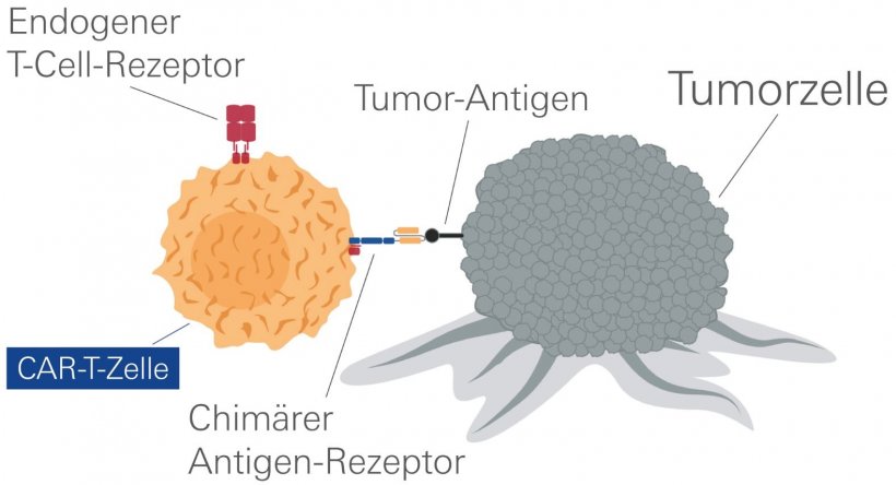 CAR-T-Zell-Präparate wie Ide-Cel nutzen chimäre Antigenrezeptoren, um...