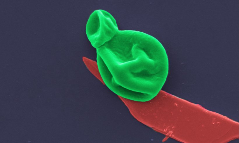 Eine Pilzzelle (grün), die mit einer nanodünnen Schicht schwarzen Phosphors...