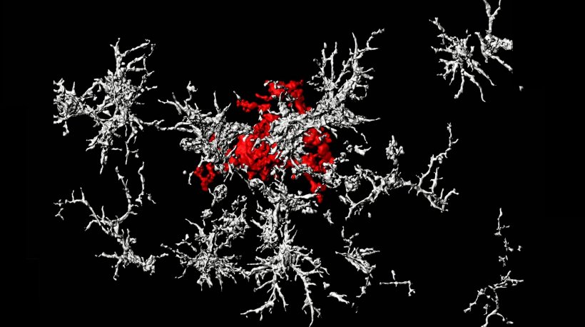 A dense-core amyloid-beta plaque (red) surrounded by microglia that lack TAM...