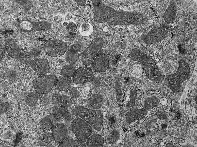 Elektronenmikroskopische Aufnahme von Mitochondrien in einer Nervenzelle.