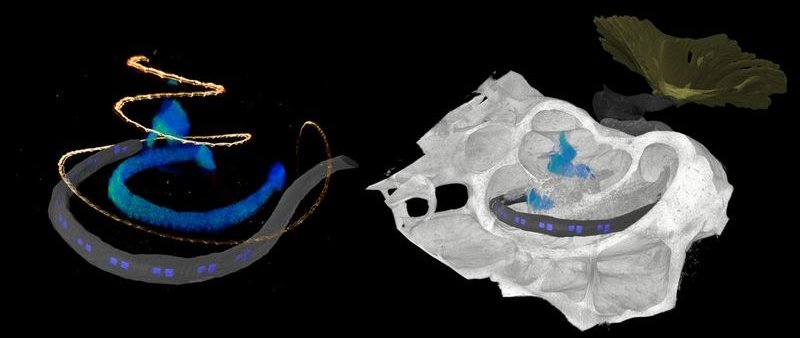 Links: 3D-Mikroskopische Aufnahme eines LED-basierten optischen...