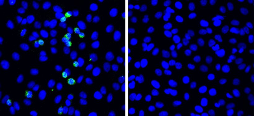 SARS-CoV-2 replication is suppressed by RIG-I. When pulmonary cells that do not...