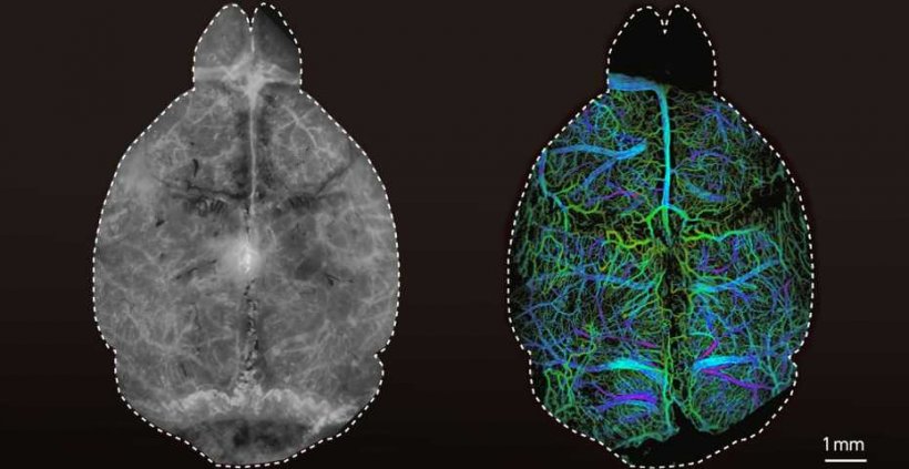 Left: Conventional fluorescence images of a mouse brain. Right: An image taken...