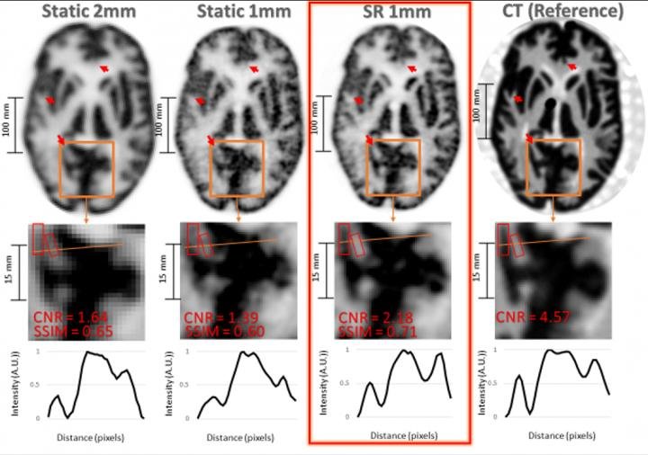 Result of the Hoffman brain phantom study. Top row: same PET slice...