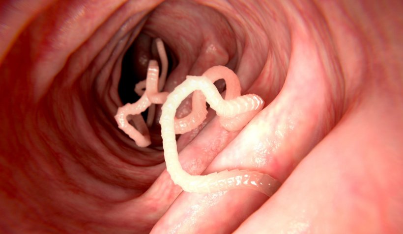 tapeworm in human intestine illustration