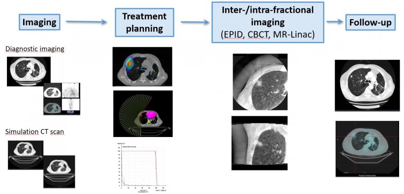 Workflow in Radiotherapy: the images (data) are there 
The whole workflow in...