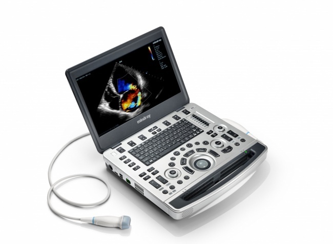 The M9 ultrasound system