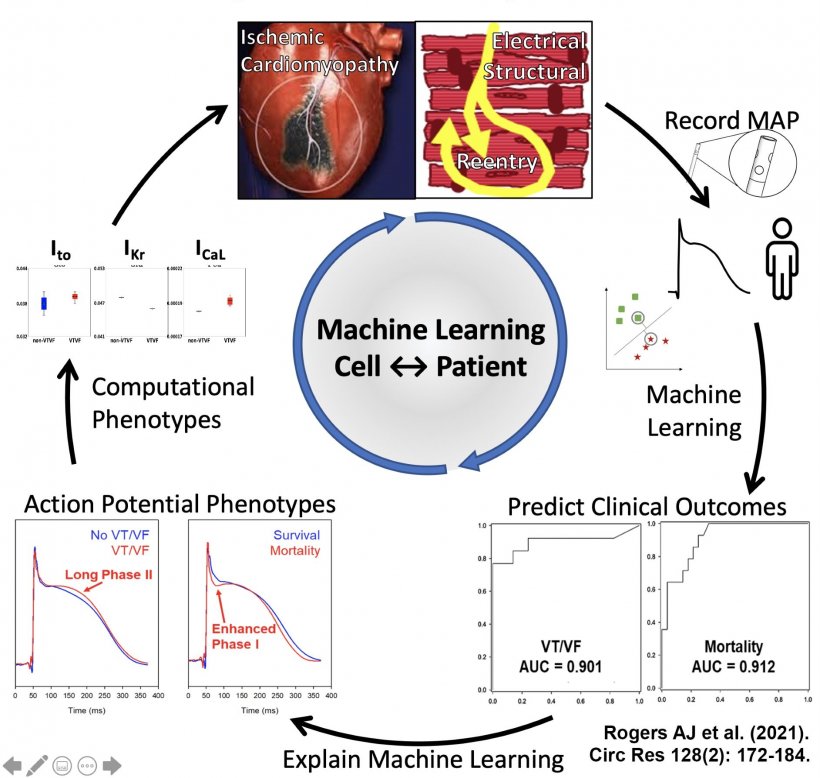 Machine Learning can predict SCD by cellular mechanisms