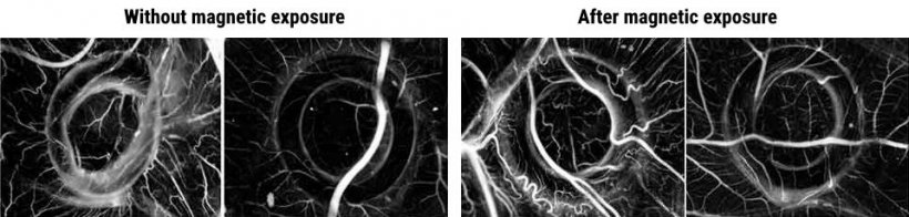 Magnetic stimulation improves ex vivo angiogenesis. The conditions associated...