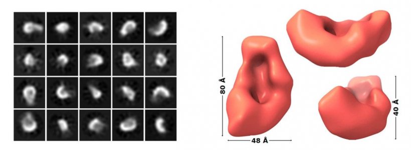Aβ oligomers in cryo-electron microscopy (left) and a 3D density...