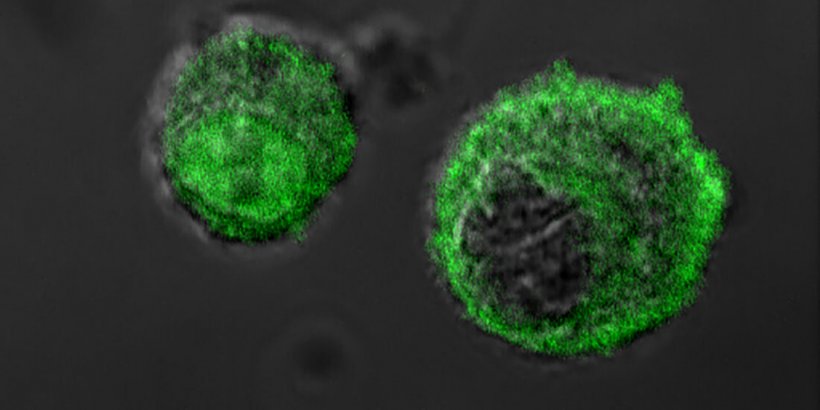 green cancer cells