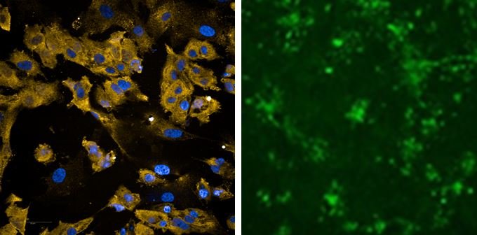 Left image: heart cells stained gold for the viral entry receptor ACE2, with...