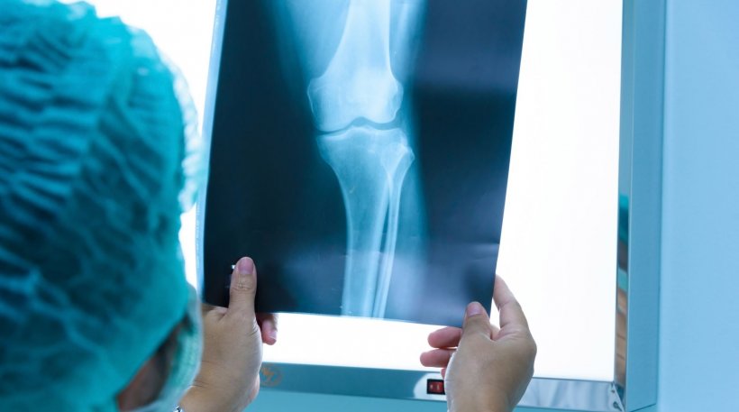 radiographer looking at xray image of knee