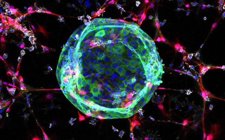 Microscopy image of an organoid (green) co-cultured with fibroblasts (red) and...