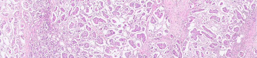 Roche opens access to digital pathology tools