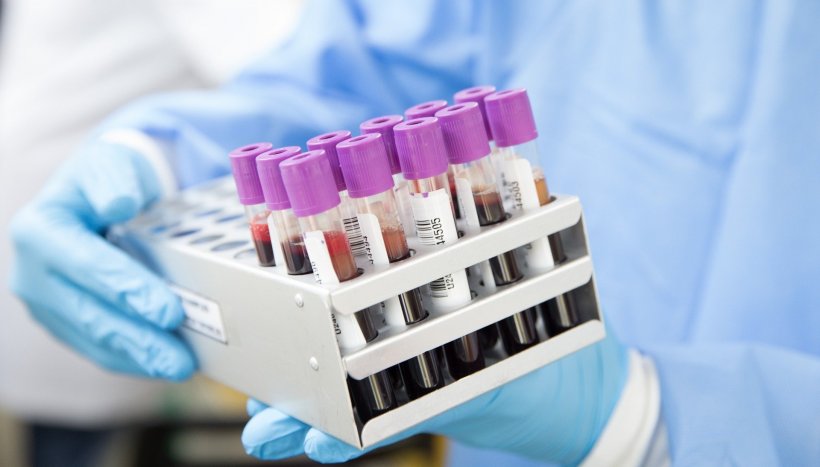 Tubes with blood samples (symbolic photo)