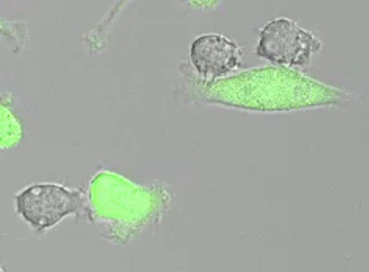 Macrophages (grey) attacking tumor cells (green)