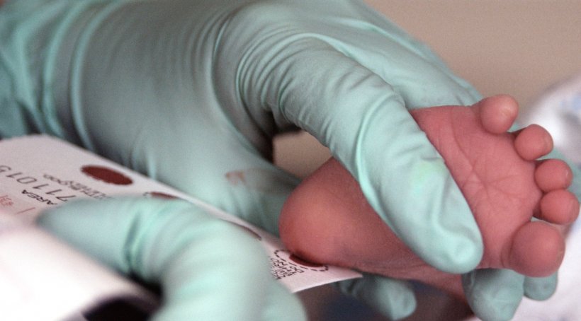 The blood of a two week-old infant is collected for a Phenylketonuria (PKU)...