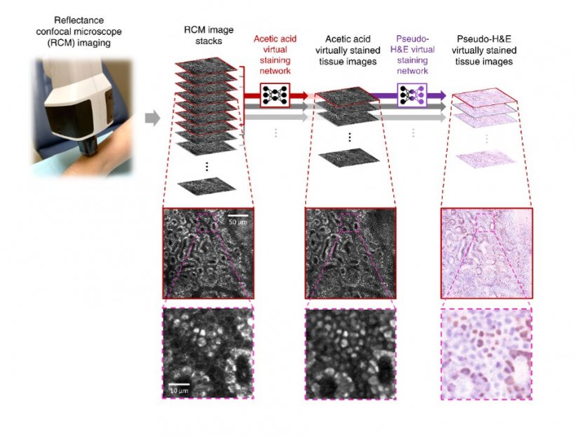 UCLA team achieves biopsy-free virtual histology of skin using deep learning...