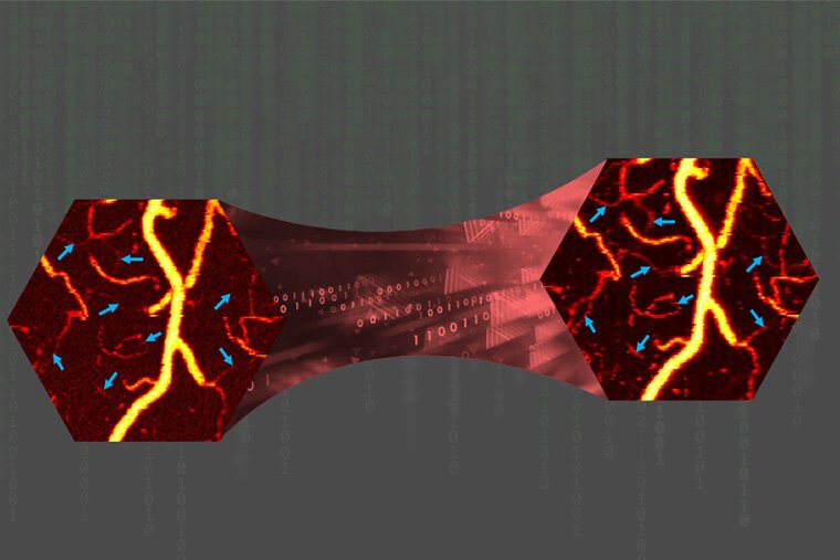 On the left is a noisy, low-fluence photoacoustic microscopy image of blood...