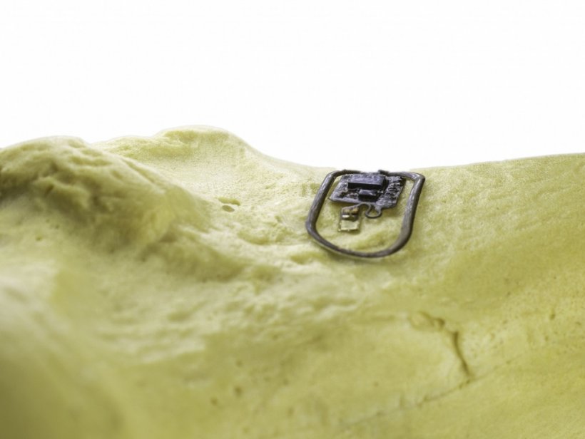 Osseosurface electronic devices, which attach directly to the bone, could one...