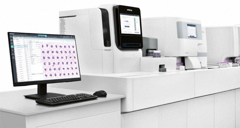 Mindray’s new automated digital cell morphology analyzer MC-80