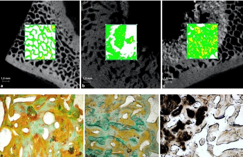 Micro-CT and histology: (a) autologous, (b) allogenic, (c) Nanobone: bone...