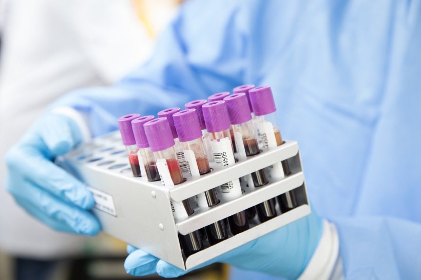 Tubes with blood samples (symbolic photo).