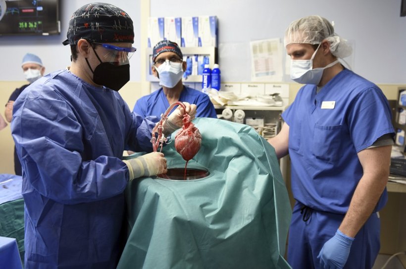 Members of the surgical team show the pig heart for transplant into patient.