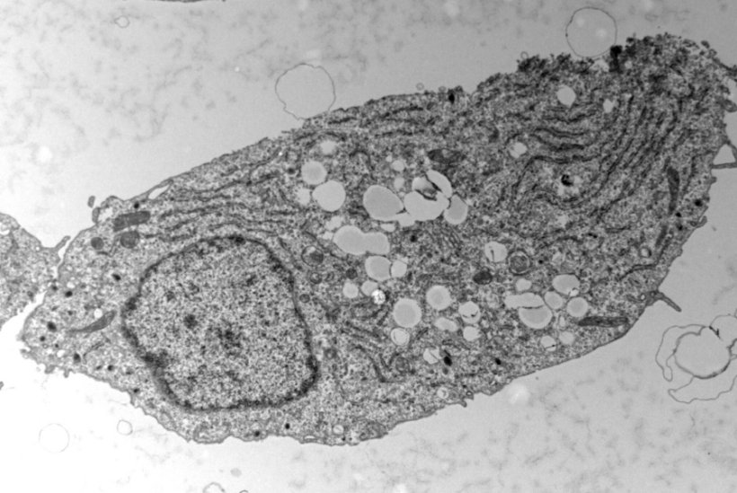 Pancreatic beta cell under electronic microscopy. The white circles visible in...