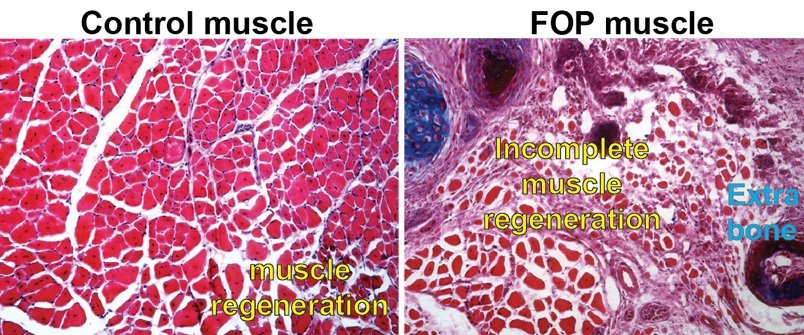 An image of a control cell with normal muscle regeneration compared to a cell...