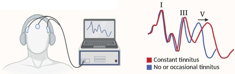 Schematic overview of swedish tinnitus research project