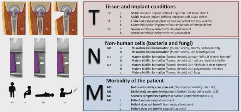 Overview of the TNM classification for periprosthetic joint infection