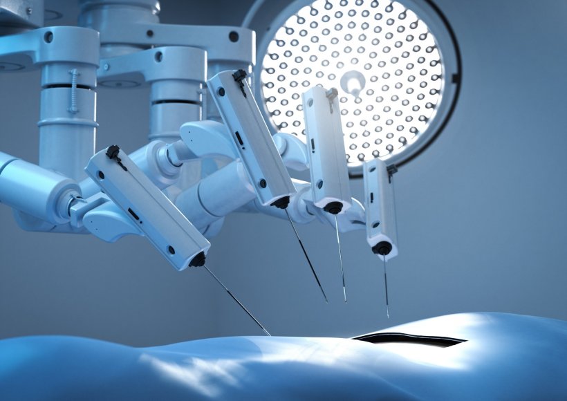 Reticencia a la cirugía robótica en europa
