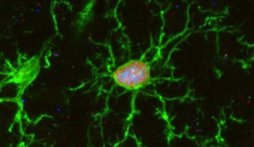Microglial cell (green) having just divided (red labelling) and already in the...