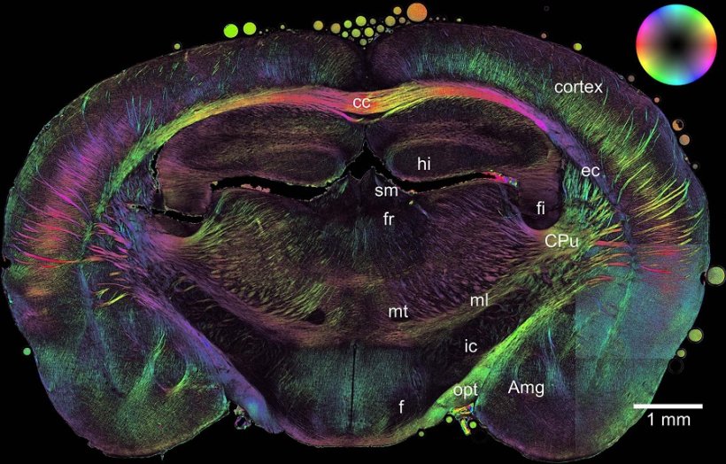3D polarized light imaging scan of a mouse brain. The structural information...