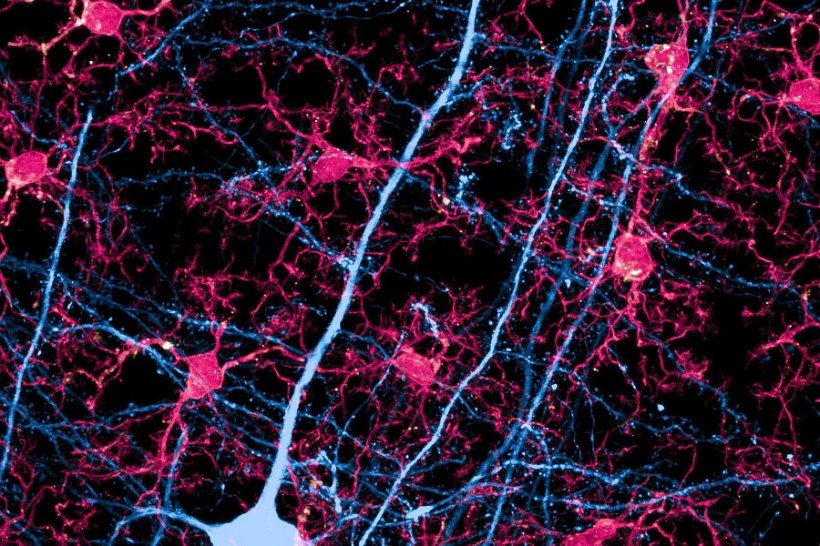 Ein Neuron und dessen Fortsätze (in Blau) sowie zahlreichen Mikrogliazellen...