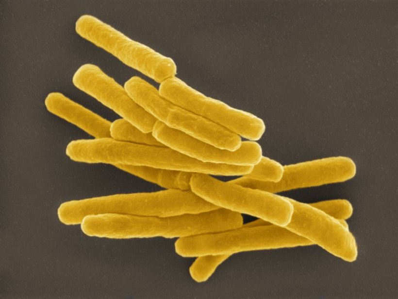 Mycobacterium tuberculosis unter dem Elektronenmikroskop. Kolorierung: Andrea...
