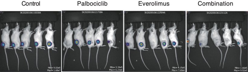 Effect of palbociclib on ATLL tumors in mice. ATLL tumors grafted into mice...