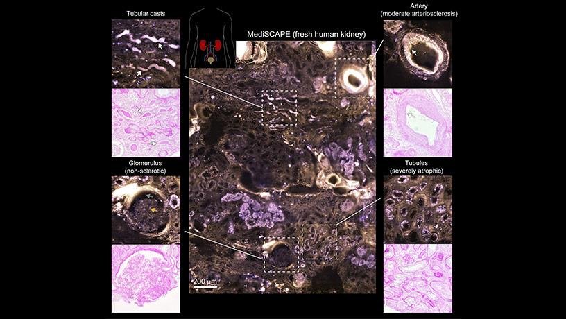 MediSCAPE imaging of fresh human kidney compared to gold standard periodic...